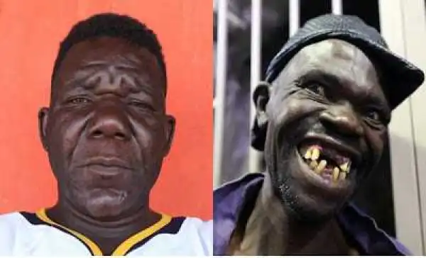 "Ugliest man